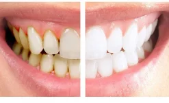 стоматология белый жемчуг изображение 3 на проекте infodoctor.ru